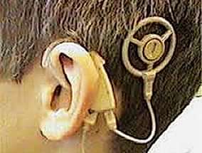 İŞİTME KONUŞMA TESTLERİ